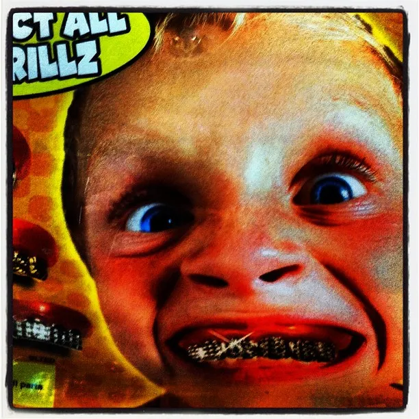 Close-up of a young boy’s exaggerated facial expression with wide eyes and toy metallic grillz over his teeth, part of product packaging.